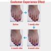 Séparateurs d’Orteils – Confort et Bien-Être pour Vos Pieds - Pedi-Sense