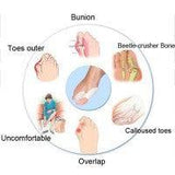Séparateurs d’Orteils – Confort et Bien-Être pour Vos Pieds - Pedi-Sense